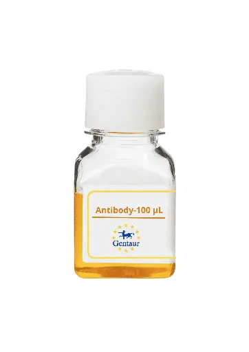 [CSB-PA847209HD01HU] ALKBH3 Antibody  Biotin conjugated   