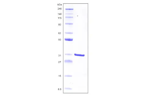 [MC02-100] Recombinant Human Galectin 3, His Tag -100 ug