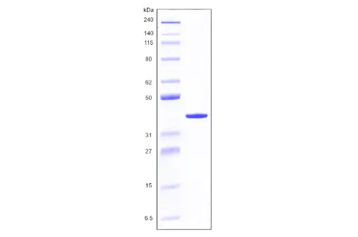 [MC03-025] Recombinant Human Galectin 8, variant 1, His Tag (317 a.a.) -25 ug