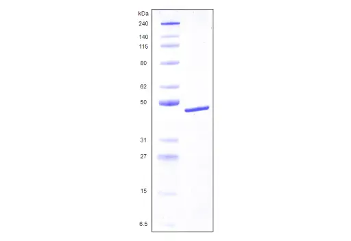 [MC04-100] Recombinant Human Galectin 8, variant 2, His Tag (359 a.a.) -100 ug