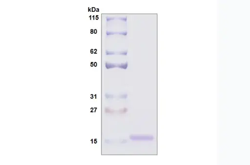 [MC06-100] Recombinant Human Galectin 10, His Tag -100 ug