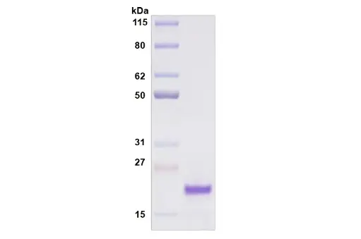 [MC11-025] Recombinant Human Siglec-8, His Tag -25 ug